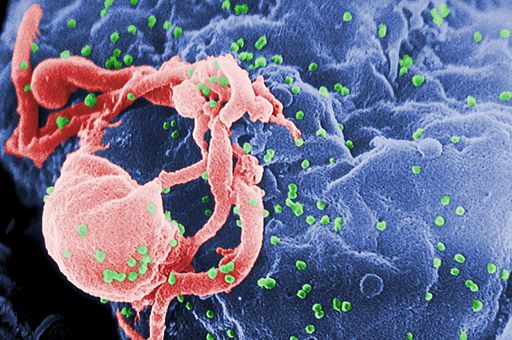 HIV virions, highlighted in green, emerge on cultured tissue. Image is public domain, courtesy of the CDC Public Health Library. Retrieved from Wikimedia Commons. HIV-budding-Color