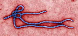 A single Ebola virion.